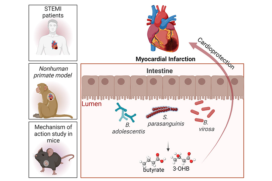 Unlocking the Gut-Heart Connection: Butyrate-Producing Bacteria Aid Post-MI Recovery